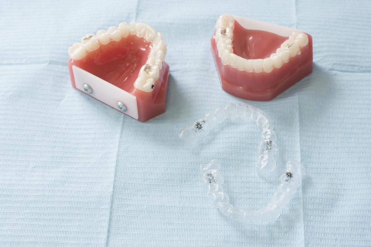 ortodoncia-alineadores